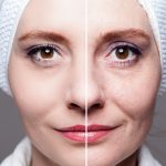 Zvädnutá pleť, čierne uhry či začervenanie?