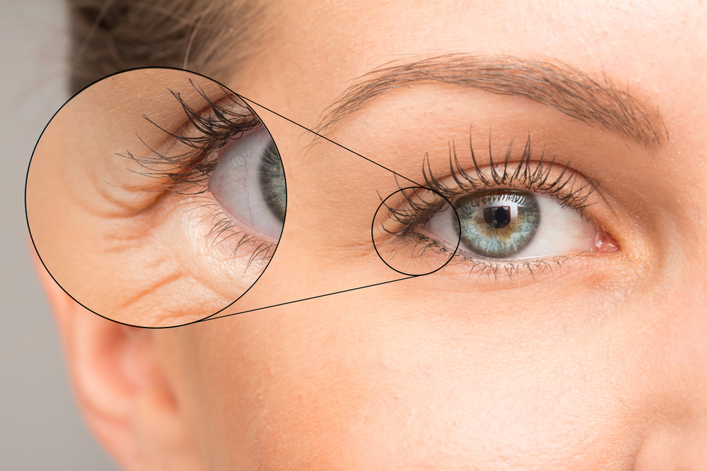 Odkiaľ pochádzajú prvé vrásky? 8 potravín, ktoré urýchľujú starnutie