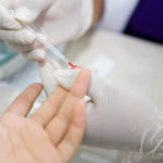 Vyšetrenie z kvapky krvi